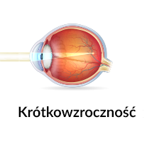 badanie wzroku u dzieci bydgoszcz