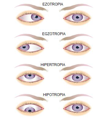 soczewki kontaktowe bydgoszcz